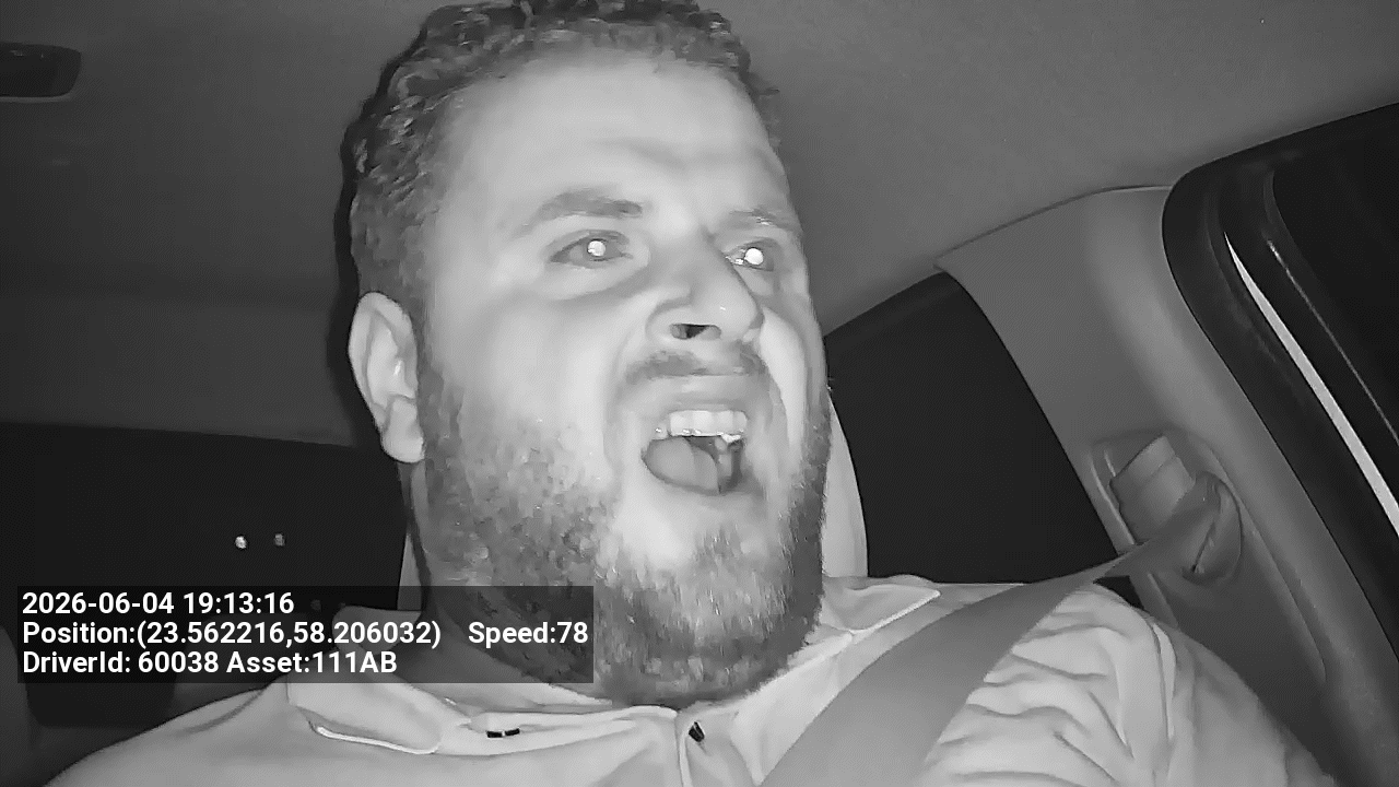 AFDD Yawning Detection